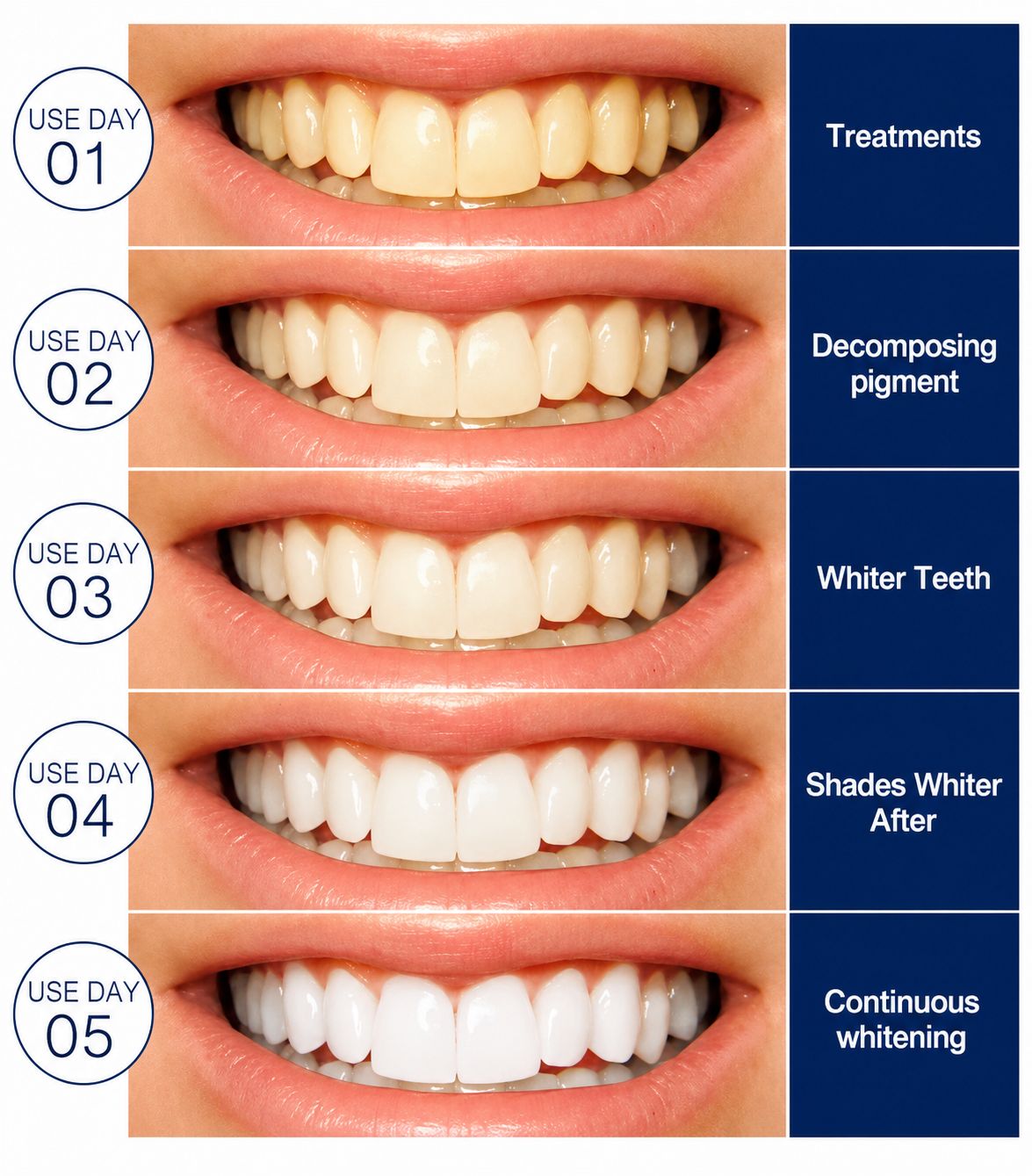 Teeth whitening strips 28 treatments / 56 strips", "sensitive teeth friendly"